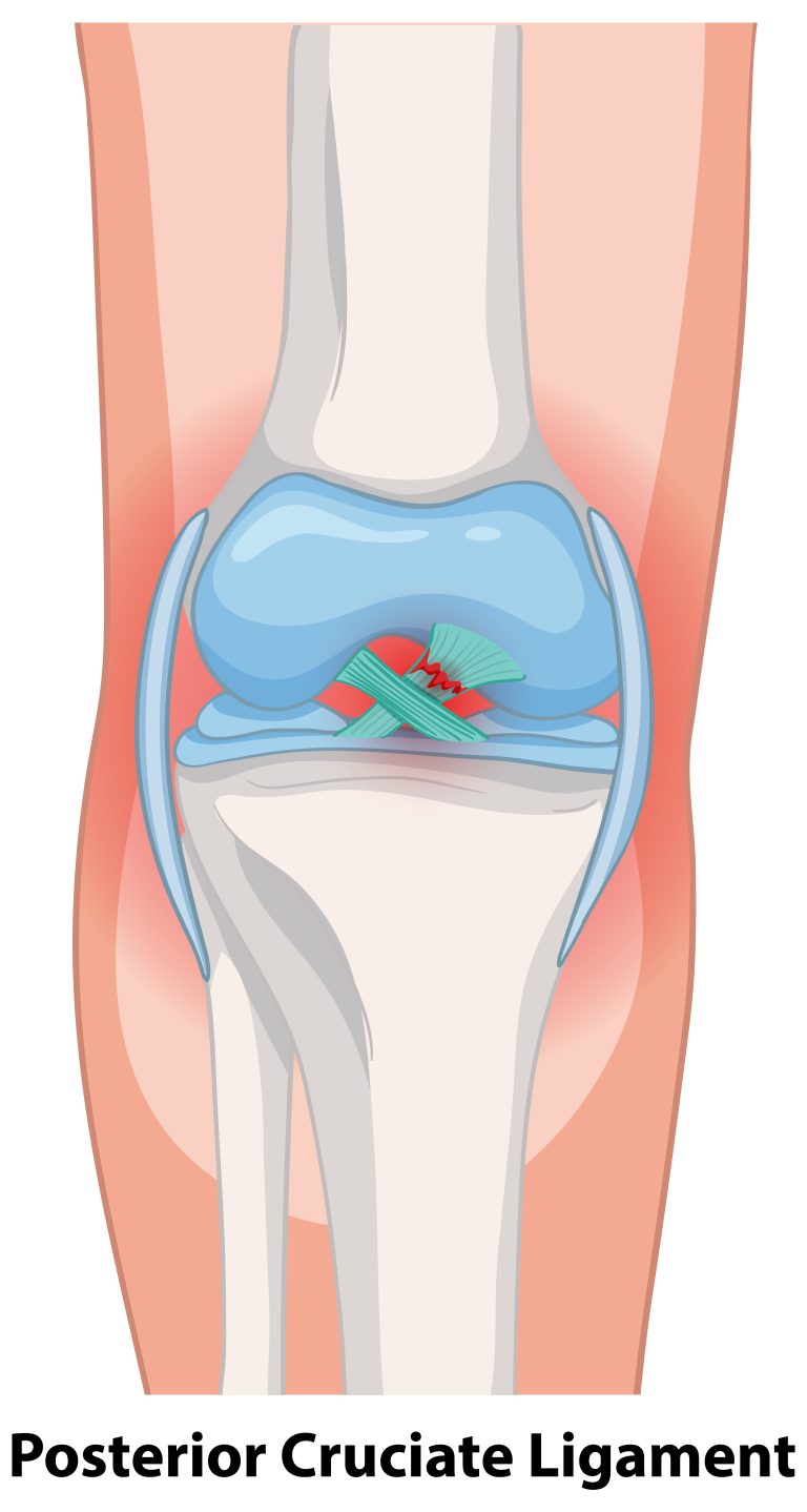 Posterior Cruciate Ligament