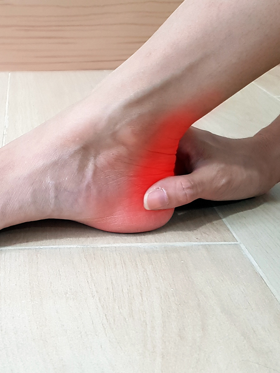 A woman with achilles pain