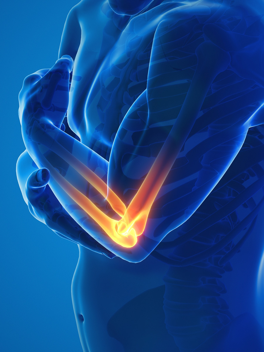 3D illustration of a man with elbow pain