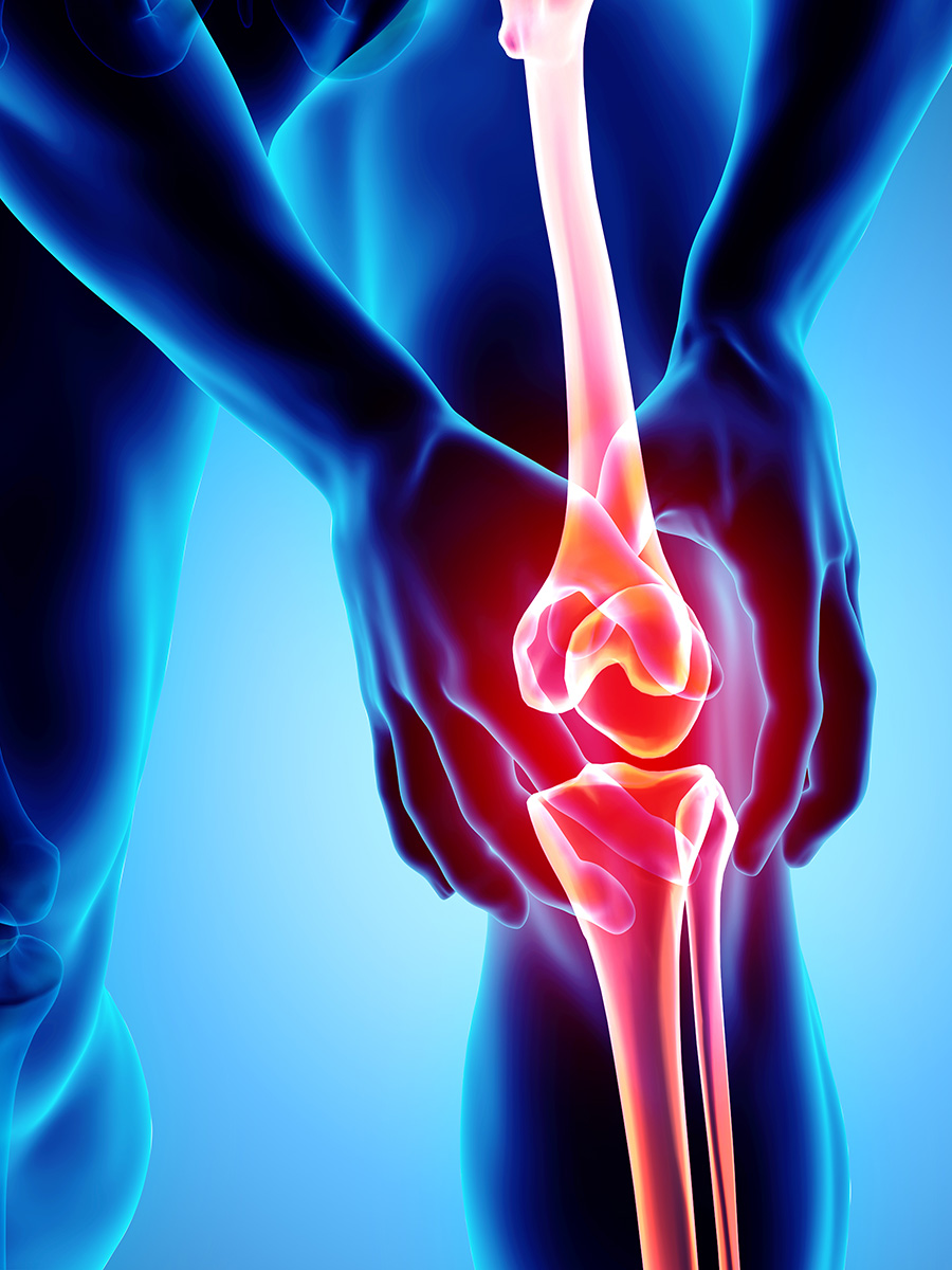 Graphic of a person with knee pain