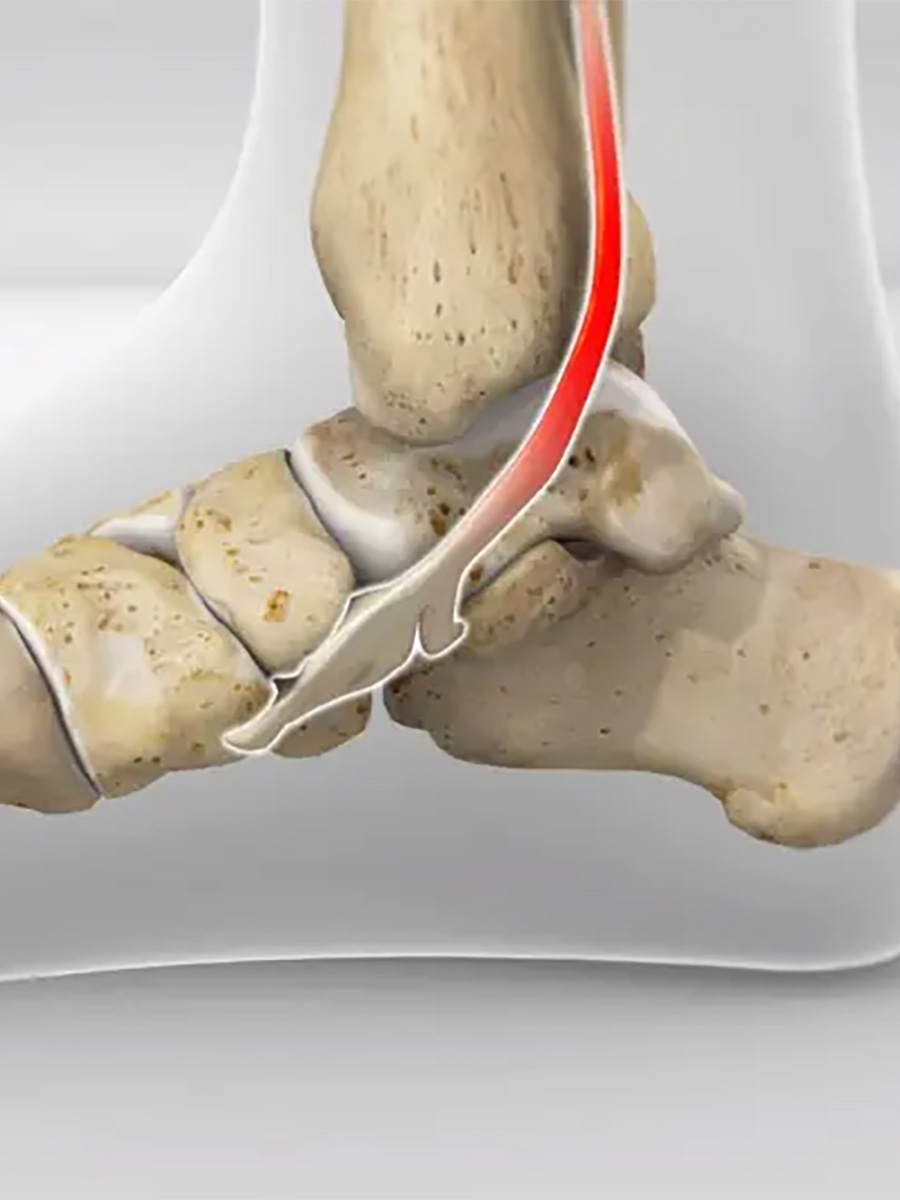 Diagram of a human foot