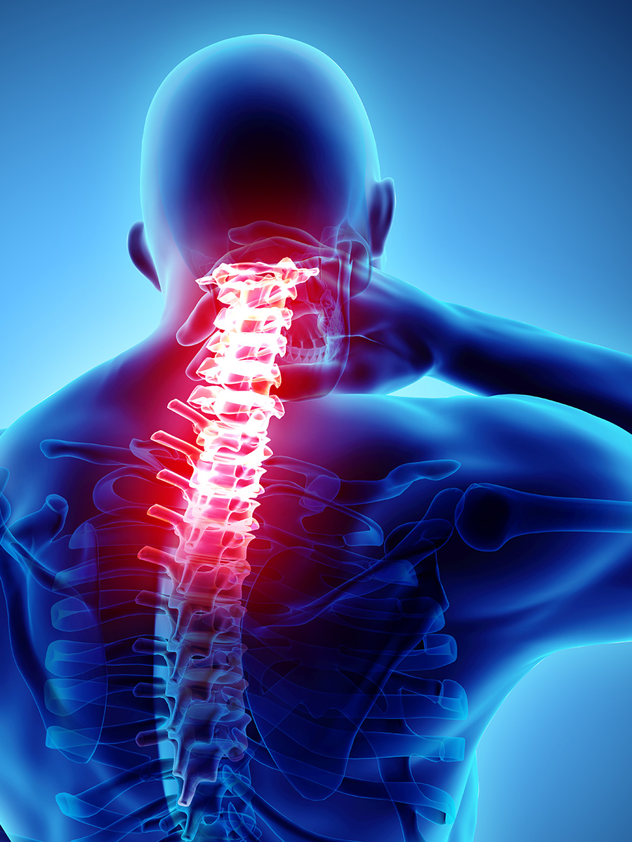 3d rendition of a person rubbing his neck