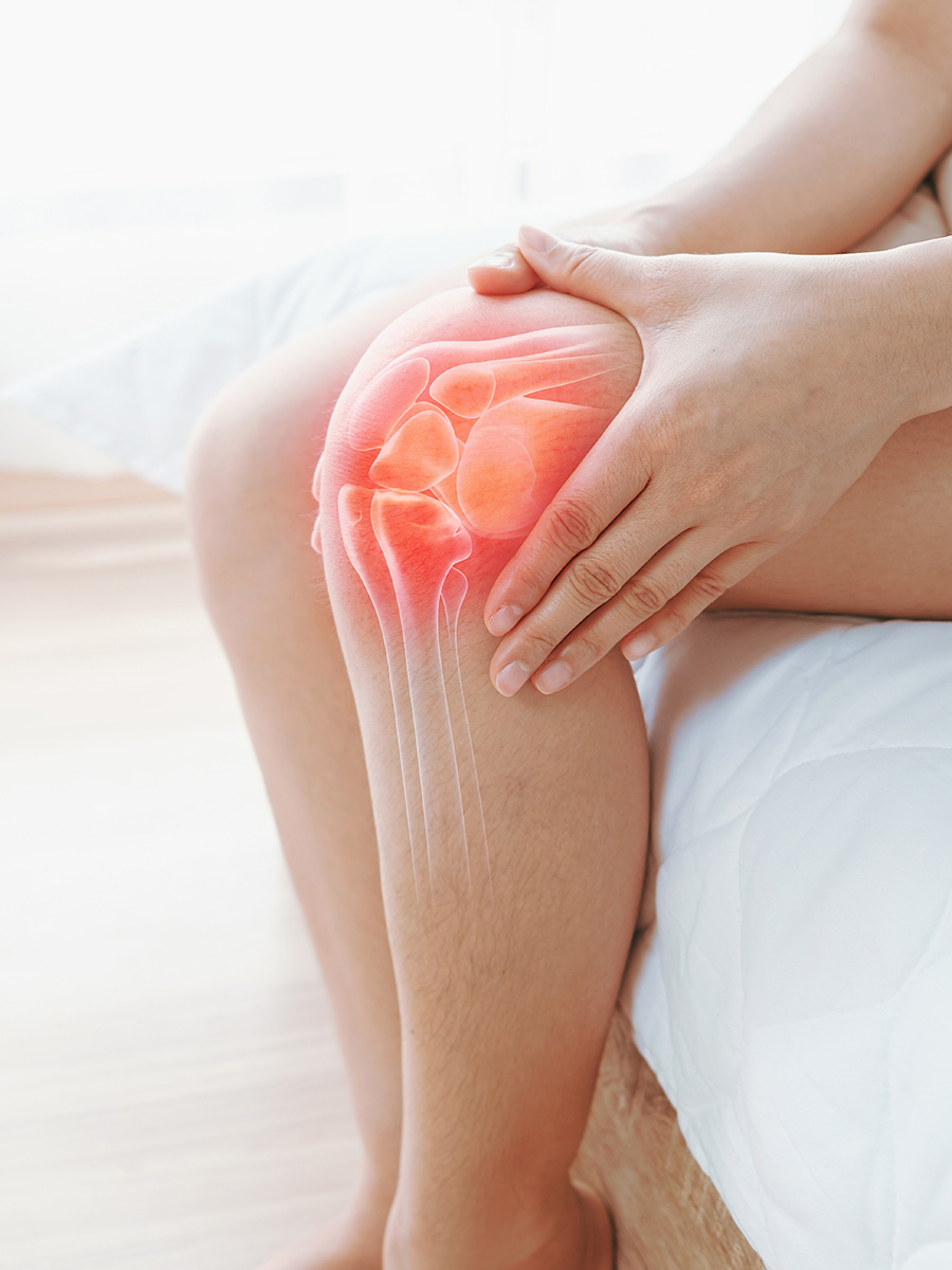 X-ray of a woman holding her knee